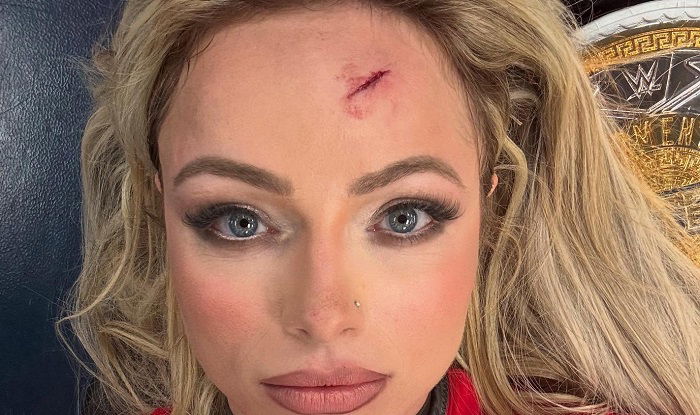 Liv Morgan Shows Off Injury She Suffered During 6/2 WWE Raw, Update On TNA Title In NXT, Roman Reigns Reaches Rare Milestone