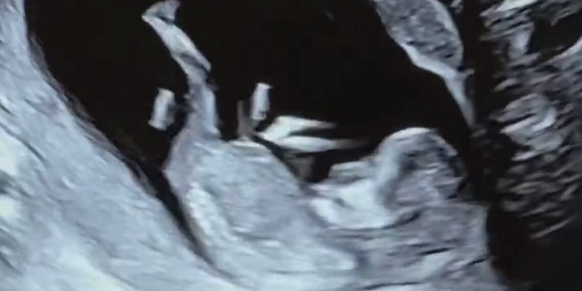 Naomi baby sonogram photo | Source: @Trinity_Fatu on X