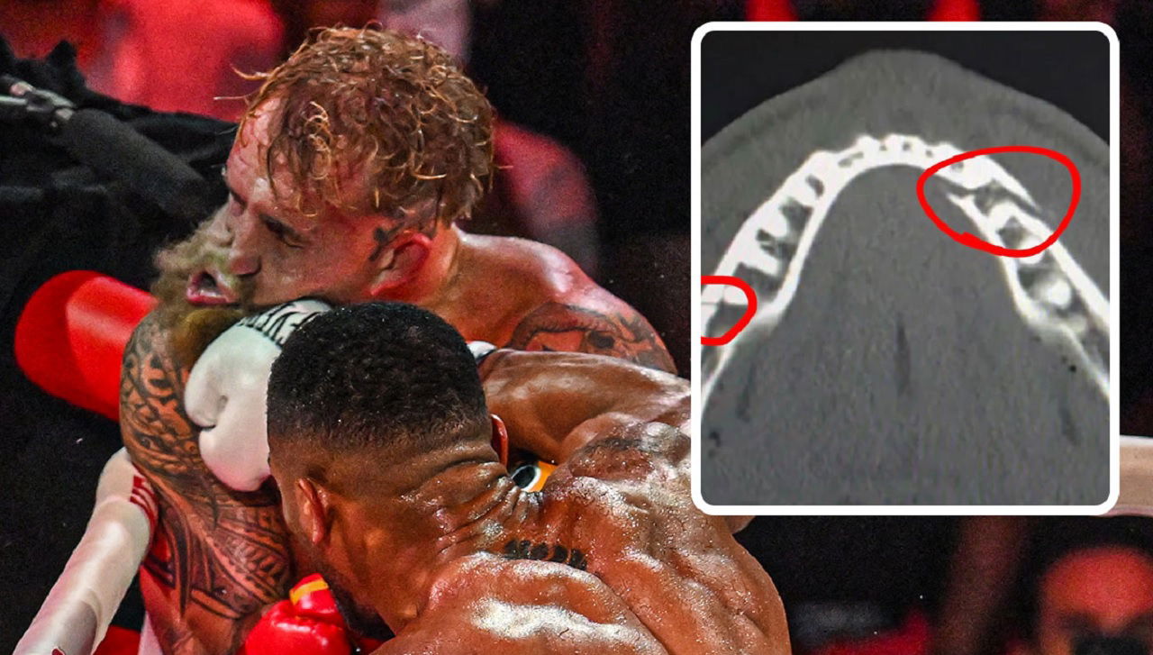 Logan Paul Reacts To Jake Paul Suffering Double Broken Jaw In KO Loss To Anthony Joshua, Jake Says “Give Me Canelo …” Logan Paul Reacts To Jake Paul Suffering Double Broken Jaw In KO Loss To Anthony Joshua, Jake Says “Give Me Canelo …”