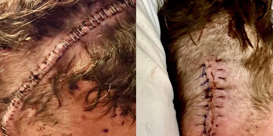 Joe Doering battling brain cancer again | Source: GoFundMe