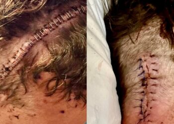 Joe Doering battling brain cancer again | Source: GoFundMe