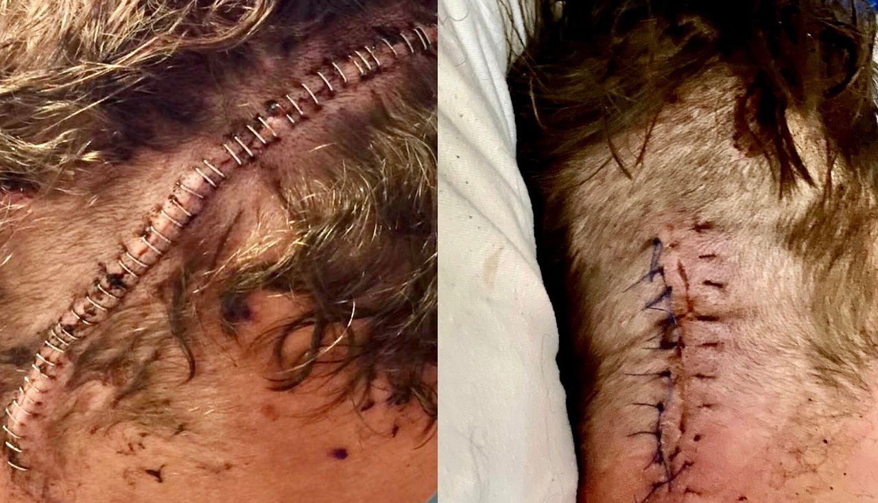 TNA Wrestling Star Launches GoFundMe After Third Brain Tumor Diagnosis