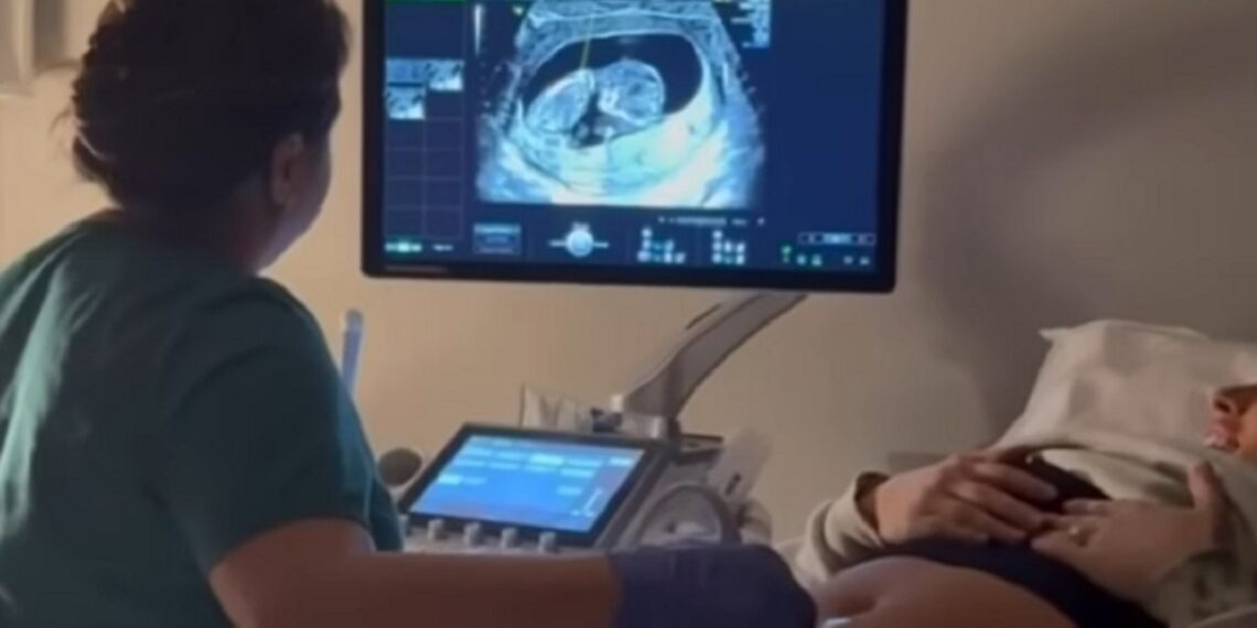 Mandy Rose gets a sonogram after learning she is pregnant | Image Source: Mandy Sacs on Instagram