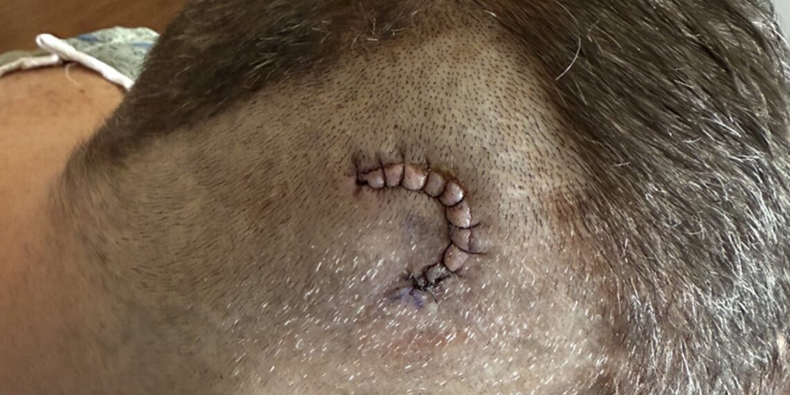 Jim Ross shares post-brain surgery photo | Image Source: @JRsBBQ on X